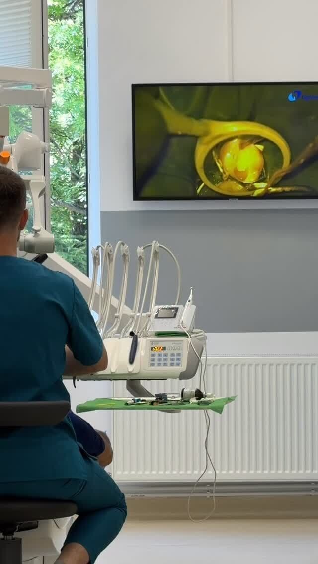Medic la unitul dentar; pe monitorul de pe perete, imaginea mărită a dintelui tratat la microscop